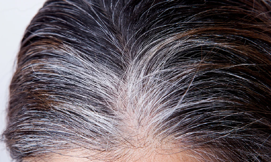 effet bétadine sur cheveux blancs